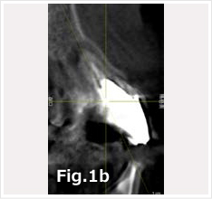 Sagittal aspect