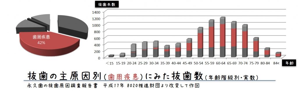 歯周疾患